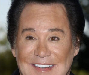 Face Lift? It wasn’t a Face Lift?